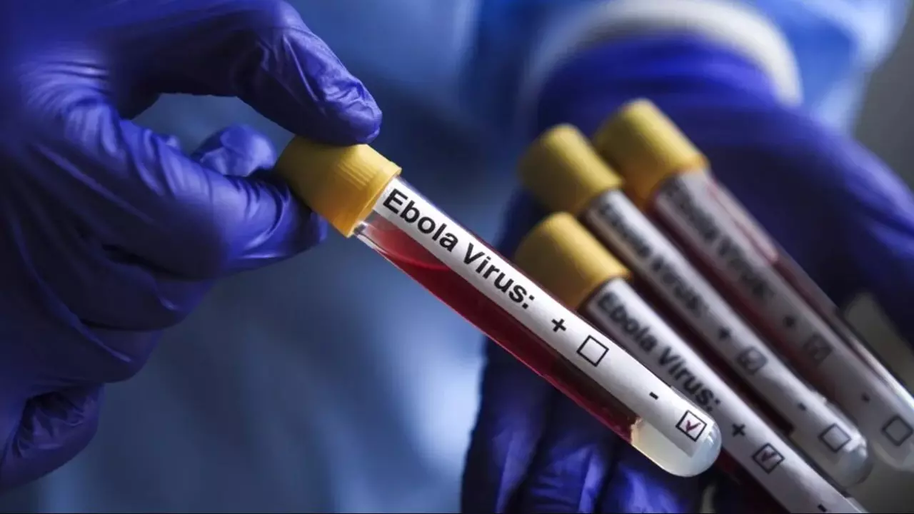 Ebola Virus: भारत में इबोला की दस्तक का खतरा,युगांडा से लौटी महिला में मिले गंभीर लक्षण